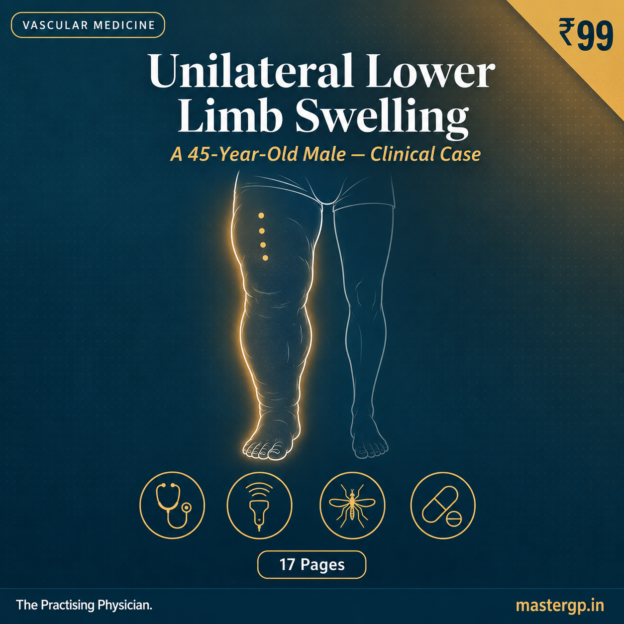 Unilateral Right Lower Limb Swelling — GP Topics Clinical Case